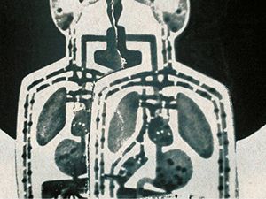 Addio Mark Linkous degli Sparklehorse, il ricordo dei Radiohead