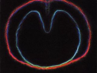 XTC