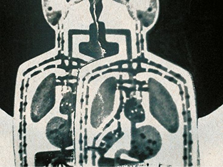 Radiohead, ascolta la versione di &quot;Spooks&quot; di Jonny Greenwood